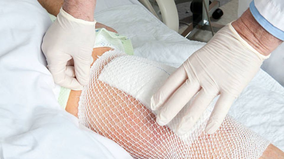Knee Replacement Recovery Tips 5 Tips for Smooth Recovery After Surgery